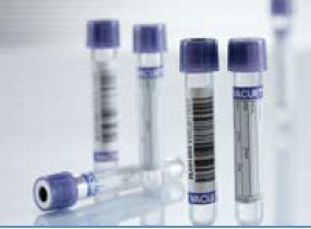 Tubes VACUETTE® Venous Blood Collection Tube K2 EDTA Additive 13 X 75 mm 4 mL Lavender / Black Ring Pull Cap Polyethylene Terephthalate (PET) Tube Lavender / Black Ring (50/PK 24PK/CS) by Greiner Bio-One  ID 454209